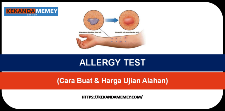 BUAT ALLERGY TEST